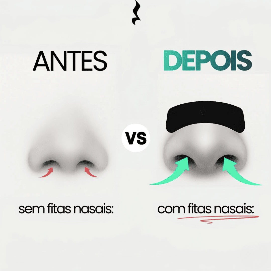 Pack Fitas Nasais