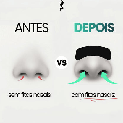 Pack Fitas Nasais