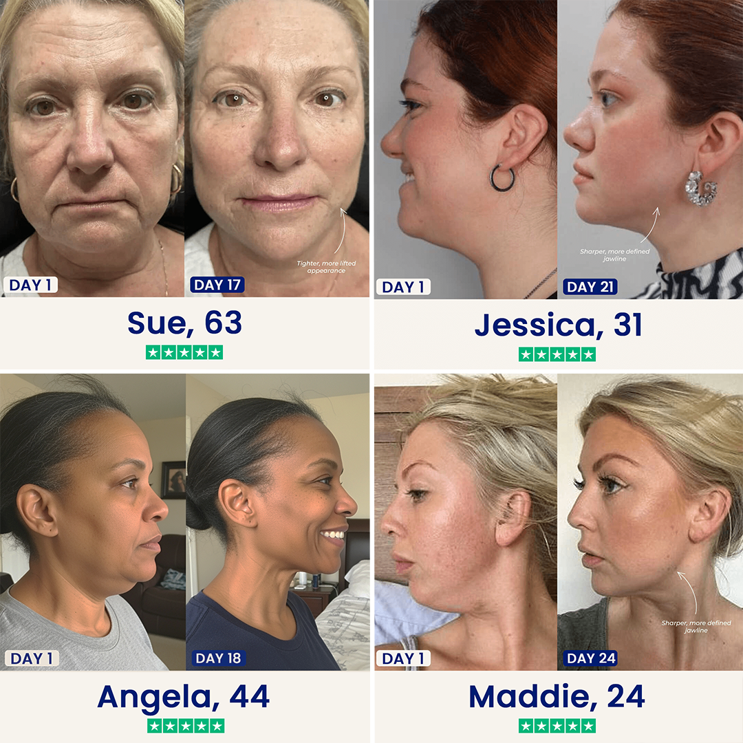 Ovornix™ Double Chin Lifting Mask