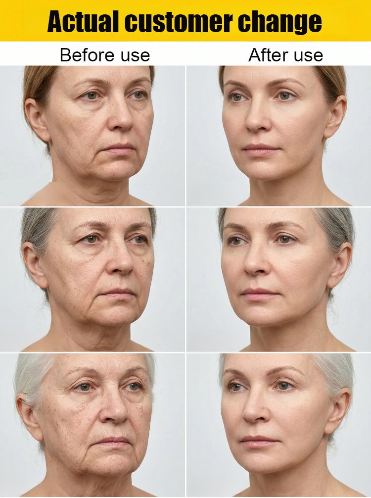 🏆Flash Sale⚡NESLEMY Collagen Fullerene Neck Cream – Elevate Your Neck Care Routine ✨