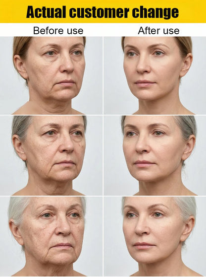 🏆Flash Sale⚡NESLEMY Collagen Fullerene Neck Cream – Elevate Your Neck Care Routine ✨