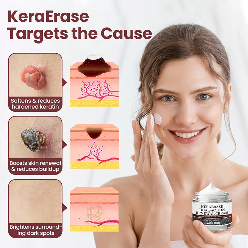 GlaciaDerm® KeraErase Dual-Action Renewal Cream